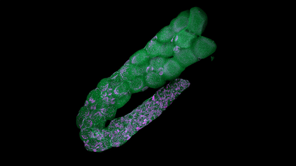 Imaging Reveals Bacterial Symbionts in the Ovaries of Tiny